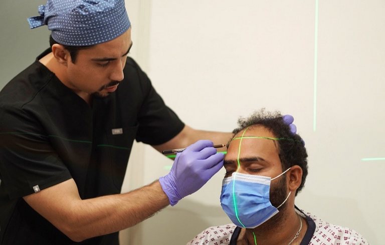 Best Hair Transplant in Islamabad